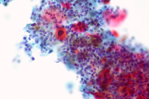 Crédito: Ed Uthman/Flickr